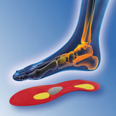 Orthopädische und Sensomotorische Einlagen